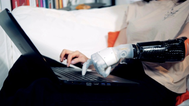 近距离看，一位女士用机械手在笔记本电脑上打字。视频素材