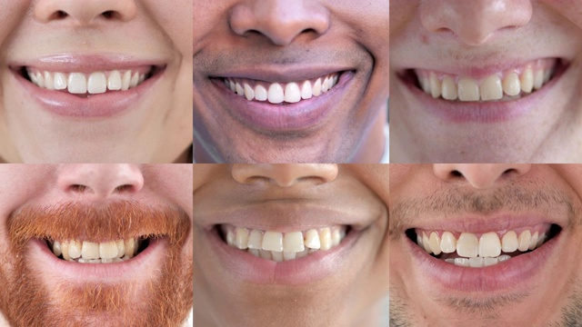 微笑的年轻人，嘴唇和牙齿的拼贴视频素材