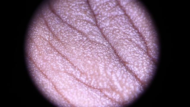 人类皮肤分析视频素材