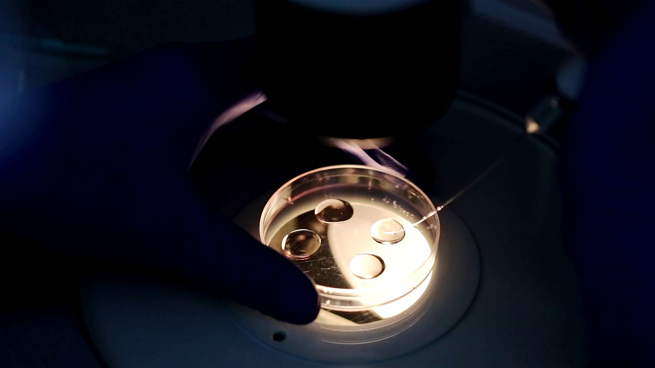 胚胎学家的手研究人类细胞。在体外受精。视频下载
