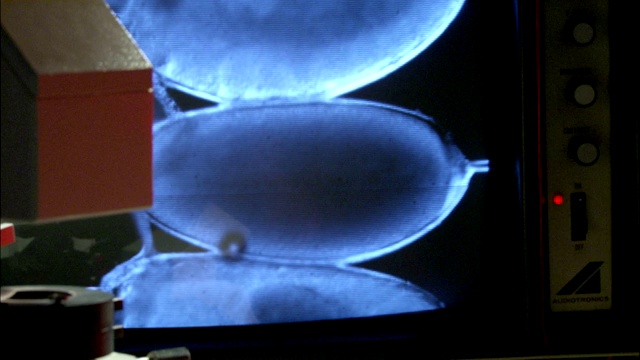 电脑显示器显示放大的胚胎。视频素材