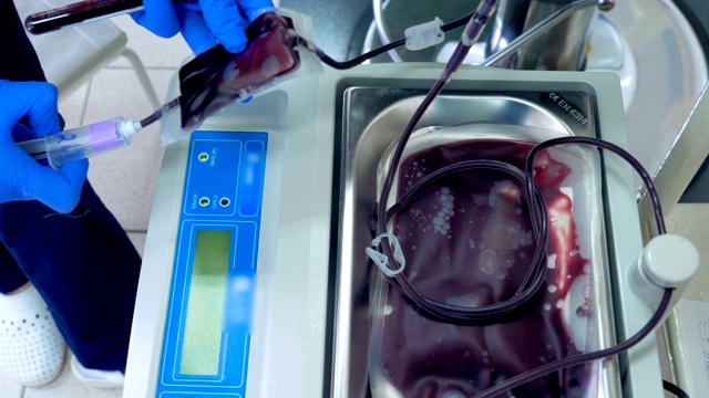护士在输血中心将塑料袋中的血液泵入导管中。视频下载
