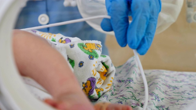 新生儿学概念，新生儿由医生和护士护理。小身体上的医疗设备。医院的产房四千美元视频素材