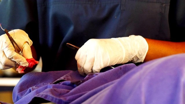 专业兽医戴着白手套切除肿瘤视频下载