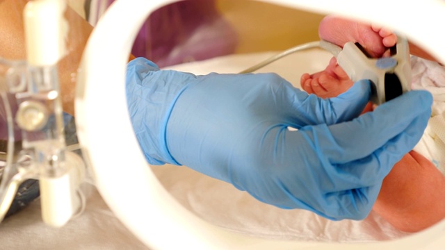 保育箱里的早产儿。婴儿足部出生后在重症监护室的病床上。新生儿出生1天，在医院产房。特写镜头。情事属实者,ICU,电联。4 k视频素材