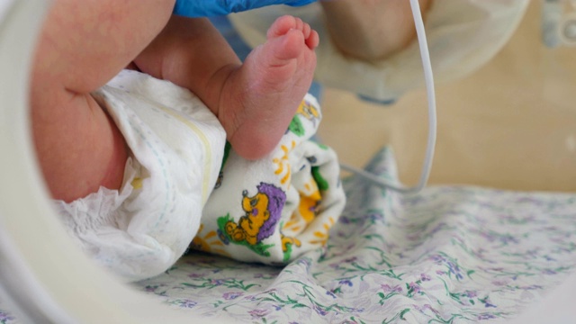 产科诊所的概念。新生儿孵化器，医院强化治疗:CCU, ICU, ITU。couveuse婴儿用力地移动手指、脚和腿。手戴手套的医生靠近。4 k视频素材