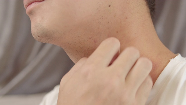 4k分辨率亚洲男子用他的手抓他痒的脖子。医疗保健和医疗理念。湿疹皮肤视频素材