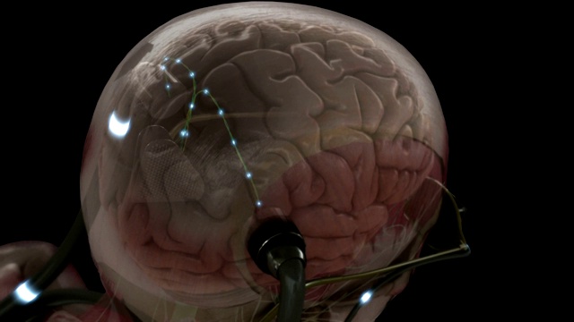 电信号通过与人脑相连的电线传播。视频下载