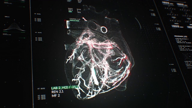 动画的用户界面HUD与身体分析和心脏移动在黑暗的背景与谷物处理的未来概念视频下载