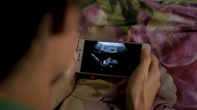 孕妇躺在床上用智能手机看超声波扫描。怀孕晚期妊娠。孕妇在手机上看超声波视频。妇科分娩诞生。视频素材