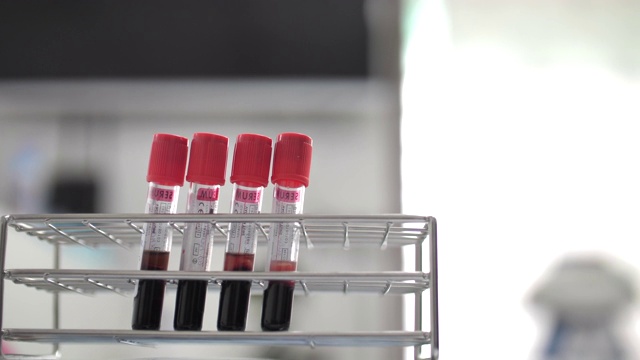 血液在实验室视频素材