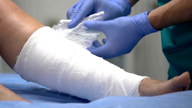 医生给病人腿上缠绷带，在医院治疗视频下载
