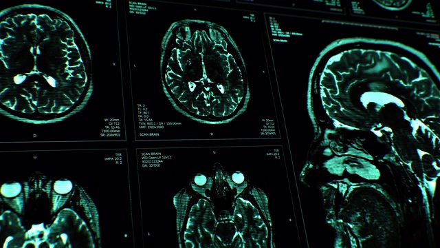 脑部核磁共振成像扫描。蓝色的。医学背景。x射线。心电图。视频下载