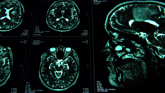 脑部核磁共振成像扫描。蓝色的。医学背景。x射线。心电图。视频下载