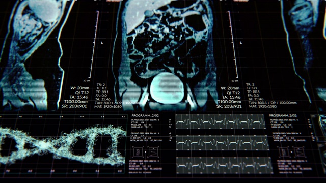 动画的用户界面HUD与身体分析和dna移动在黑暗的背景与谷物处理的未来概念视频下载