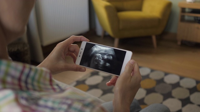 孕妇坐在家里的沙发上通过智能手机看超声波扫描。怀孕晚期妊娠。孕妇在手机上看超声波视频。妇科分娩诞生。视频素材