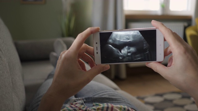 孕妇躺在家里的沙发上看智能手机上的超声波扫描。怀孕晚期妊娠。孕妇在手机上看超声波视频。妇科分娩诞生。视频素材