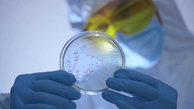 微生物学家通过光线观察细菌培养皿的特写镜头。视频素材