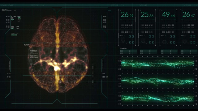 动画的用户界面HUD与大脑分析黑暗背景的网络未来概念与谷物处理视频素材