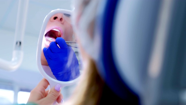女病人在预防性检查中看镜子，嘴巴特写。视频素材