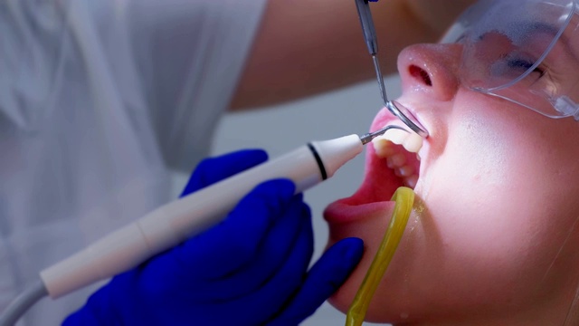 牙科保健师给女性做超声波清洁牙齿，特写。视频素材