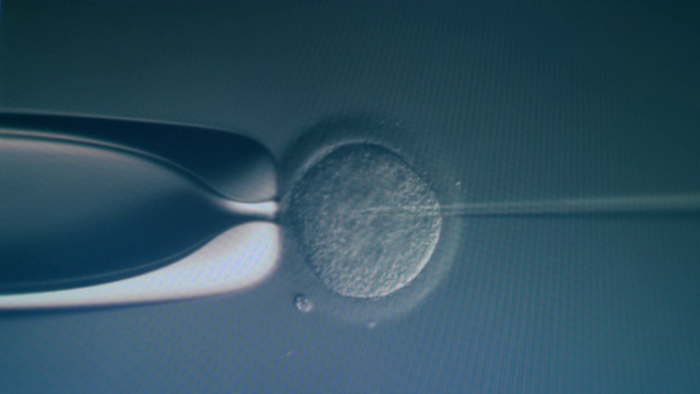 卵细胞在显微镜下受精。体外受精，体外受精过程视频素材