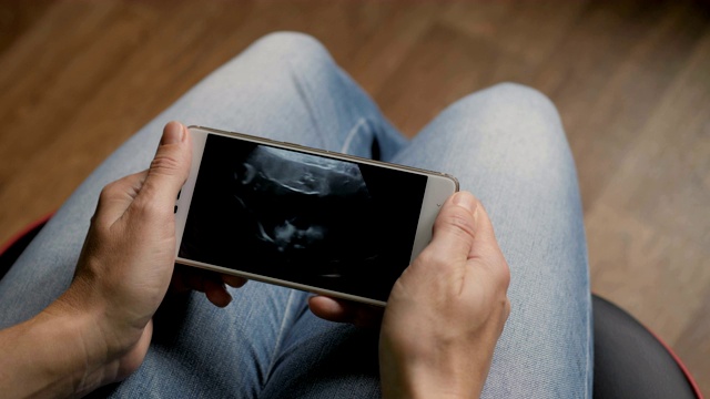 孕妇在家看智能手机上的超声波扫描。怀孕晚期妊娠。孕妇在手机上看超声波视频。妇科分娩诞生。视频素材