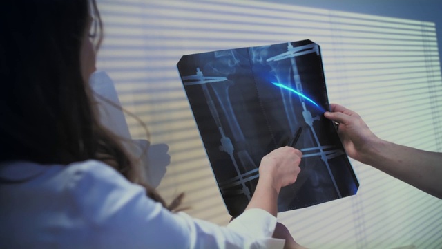 两位医生检查了x光照片。医生，女孩和男人讨论诊断。视频素材