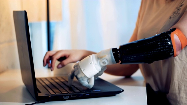 一位女士正用一只健康的机械手臂在她的笔记本电脑上打字视频素材