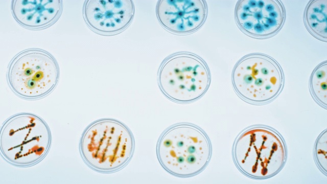 微生物实验室:科学家在显微镜下观察培养皿中的细菌，组织和血液样本。抗生素药物研究，治疗疾病。俯视图特写宏视频素材