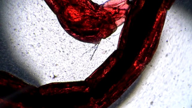 这种蚊子的红色幼虫在显微镜下是半透明的视频下载