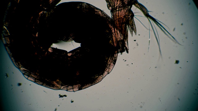 摇蚊幼虫在显微镜下移动视频下载