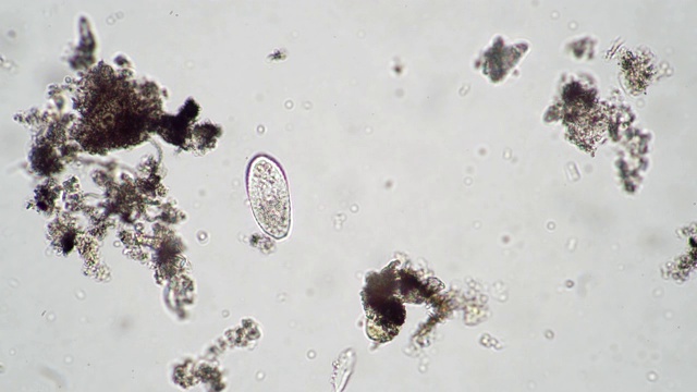 显微镜下来自河水的卵形滴虫视频下载