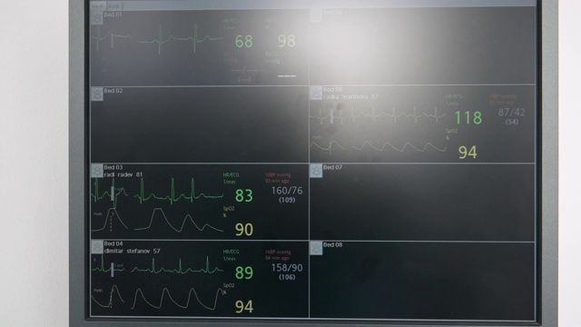 医院。铜、环境、社会和治理监控。生命体征监护仪显示心电图波形。急诊室。视频素材