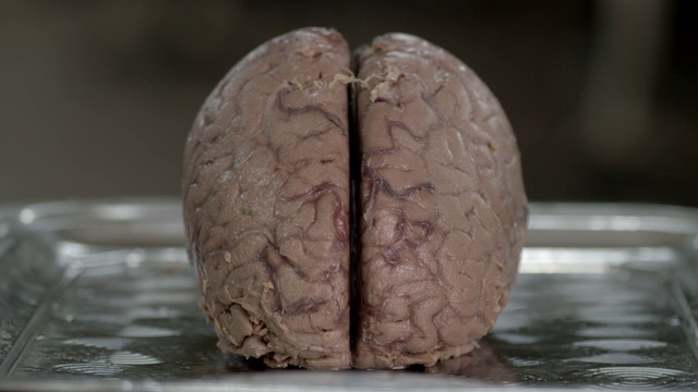 CU是人类大脑的全景图视频下载