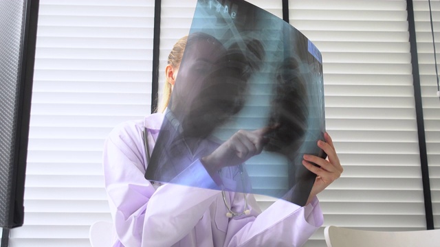 一位女医生正在看X光图像视频素材