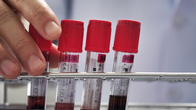 科学家在实验室验血视频素材