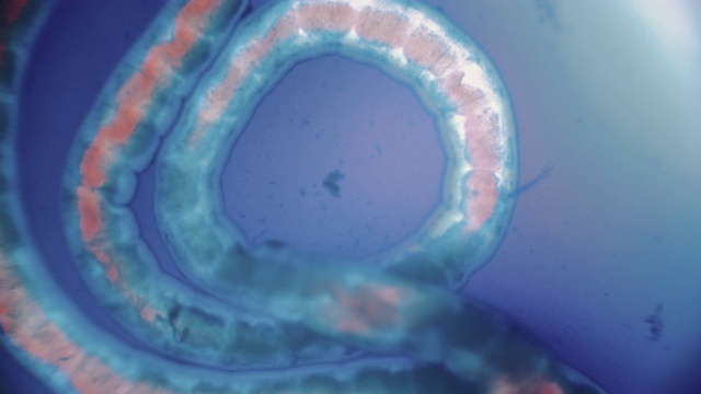 显微镜下的血虫(甘油，环节动物)视频下载