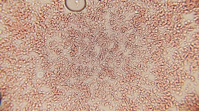 血细胞通道100x (HD 60p)。在卤素细菌显微镜下，血小板在100倍的放大下形成一个小通路。视频素材