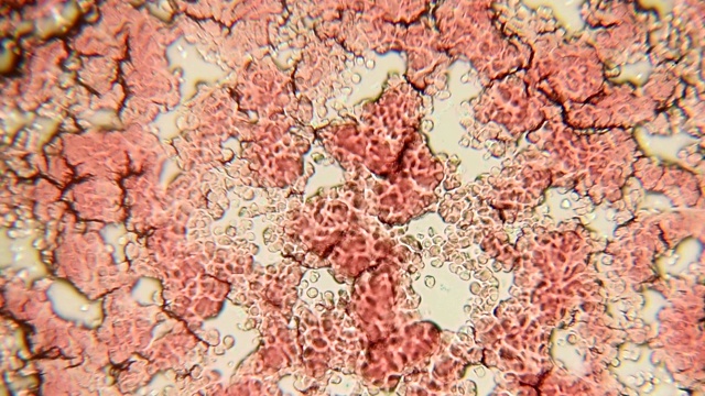 血细胞通道100x (HD 60p)。在卤素细菌显微镜下，血小板在100倍的放大下形成一个小通路。视频素材