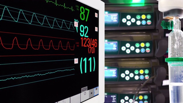 重症监护病房使用注射泵的点滴器和生命体征监测器视频素材