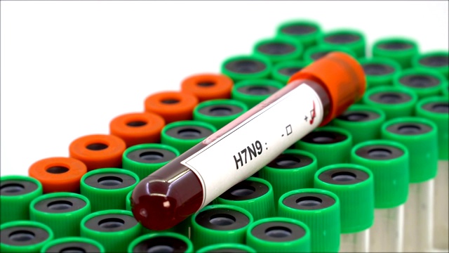 H7N9流感病毒阳性视频下载