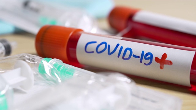 有COVID-19标签的血管视频素材