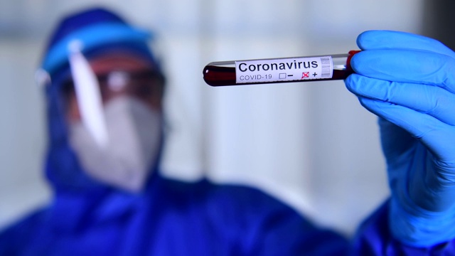冠状病毒COVID - 19检测新型冠状病毒视频下载