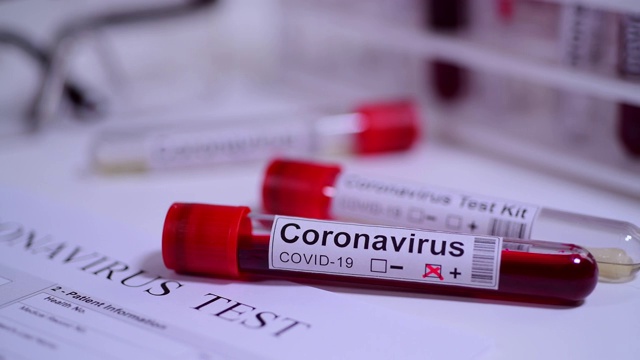 冠状病毒COVID - 19检测新型冠状病毒视频素材