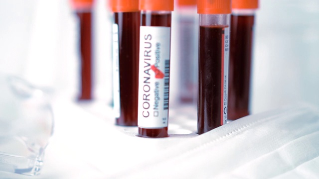 冠状病毒血液检测结果阳性和阴性视频素材