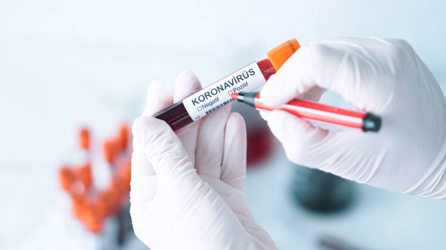 冠状病毒血液试管标记阳性-土耳其语Koronavirüs视频素材