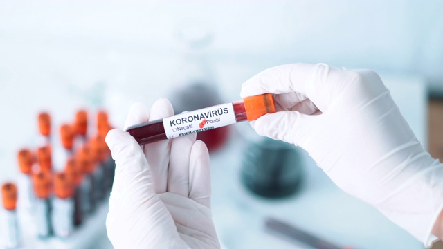 手握冠状病毒血液试管-土耳其语Koronavirüs视频素材