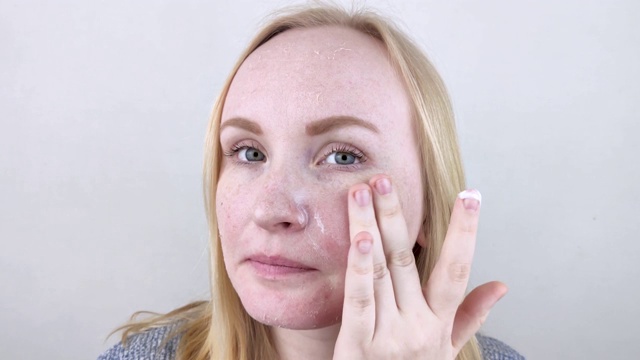 一个皮肤有问题的干燥女孩站在镜子前擦润肤霜。身体护理和干性皮肤的概念视频素材