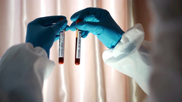 科学家正在研究Covid-19血液样本视频素材